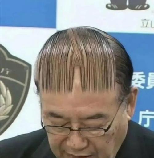 男人秃顶怎么办？（有效应对措施，拥有浓密秀发。）